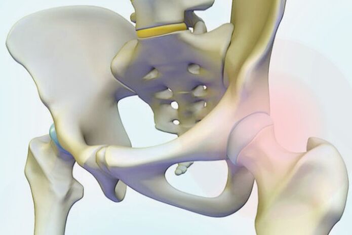 hip joint pain