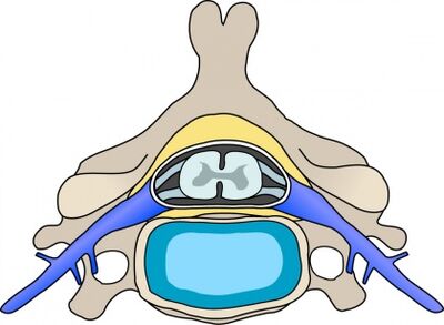Protabian in the vertebra with cervical osteochondrosis