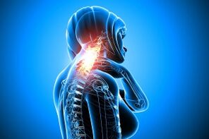 osteochondrosis in the cervical column
