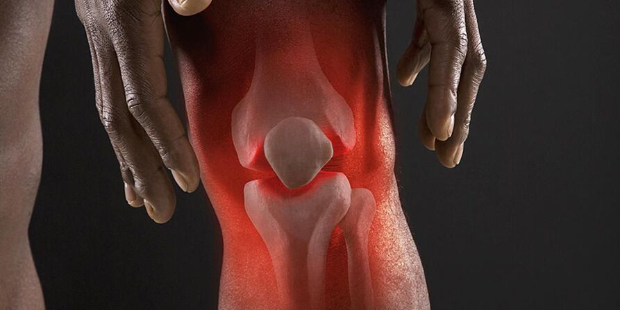 Burning sensation in the knee area is a symptom of gonarthrosis.