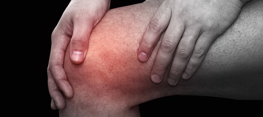 Inflammation and discomfort in the knee with gonarthrosis.